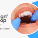 Invisalign is the top choice